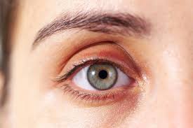 How Your Face Might Reflect Your Health: A Guide to Early Signs